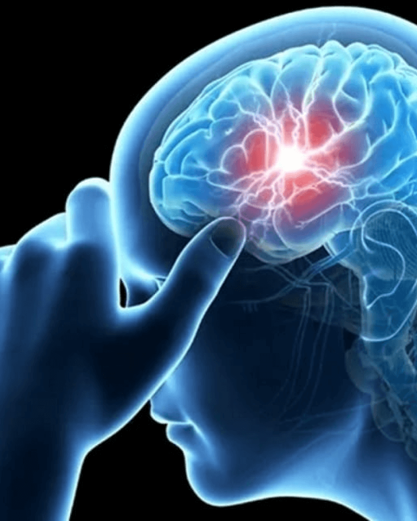 Migraine Specialist Brisbane