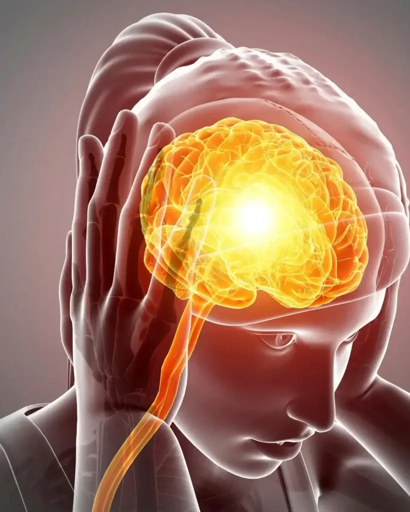 Reliable Migraine Specialist in Brisbane