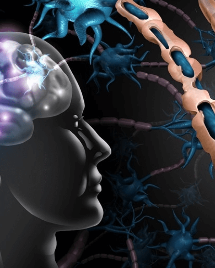 Multiple Sclerosis Specialists North Brisbane Australia Multiple Sclerosis Specialists North Brisbane Australia